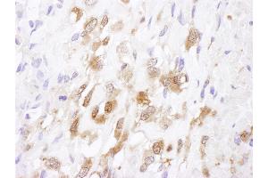 Immunohistochemistry (IHC) image for anti-Superoxide Dismutase 1, Soluble (SOD1) (AA 104-154) antibody (ABIN7454563)