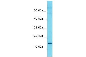 Host: Rabbit Target Name: C9orf57 Sample Type: Fetal Kidney lysates Antibody Dilution: 1. (C9ORF57 抗体  (N-Term))