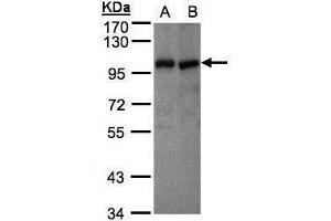 WB Image Sample(30 μg of whole cell lysate) A:MOLT4, B:Raji , 7. (VAV1 抗体  (Center))