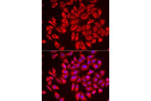 Immunofluorescence analysis of U2OS cells using DCAF7 antibody (ABIN6293269). (DCAF7 抗体)