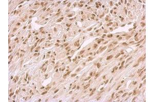 IHC-P Image BCCIP antibody detects BCCIP protein at nucleus on U373 xenograft by immunohistochemical analysis.