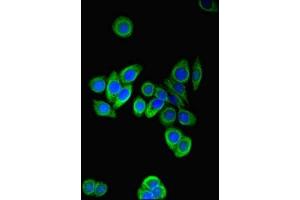 Immunofluorescent analysis of PC-3 cells using ABIN7164210 at dilution of 1:100 and Alexa Fluor 488-congugated AffiniPure Goat Anti-Rabbit IgG(H+L) (PFDN2 抗体  (AA 1-154))