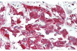 Detection of MERTK in Human Adrenal gland Tissue using Polyclonal Antibody to C-Mer Proto Oncogene Tyrosine Kinase (MERTK) (MERTK 抗体  (AA 587-858))