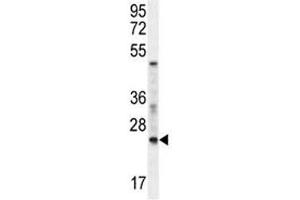 Western Blotting (WB) image for anti-RAN, Member RAS Oncogene Family (RAN) (AA 112-140) antibody (ABIN3032430)