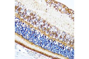 Immunohistochemistry of paraffin-embedded rat retina using CRALBP Rabbit mAb (ABIN7269934) at dilution of 1:100 (40x lens). (RLBP1 抗体)