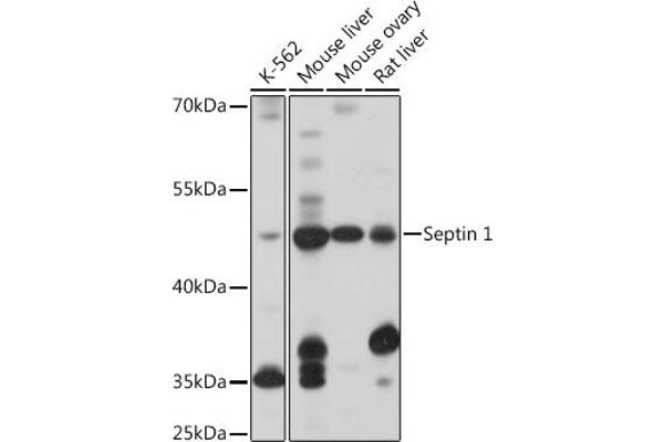 Septin 1 抗体  (AA 270-370)