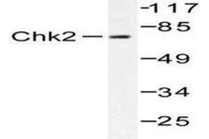 Image no. 1 for anti-Checkpoint Kinase 2 (CHEK2) antibody (ABIN265350) (CHEK2 抗体)