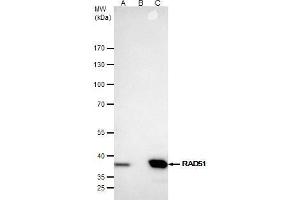 IP Image Rad51 antibody [N1C2] immunoprecipitates Rad51 protein in IP experiments. (RAD51 抗体  (Center))