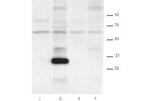 AID antibody (mAb) tested by Western blot. (AICDA 抗体  (AA 178-198))