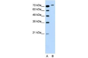 RHOBTB1 antibody used at 0. (RHOBTB1 抗体  (Middle Region))