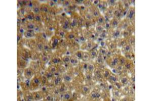 Used in DAB staining on fromalin fixed paraffin-embedded liver tissue (FSTL1 抗体  (AA 20-306))