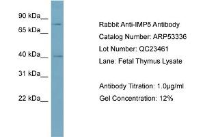 WB Suggested Anti-IMP5  Antibody Titration: 0. (SPPL2C 抗体  (Middle Region))