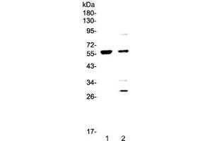 Western blot testing of 1) human COLO-320 and 2) human PANC-1 cell lysate with PDK1 antibody at 0. (PDK1 抗体  (AA 107-336))