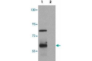 Western blot analysis of KAL1 in MCF-7 cell lysate with KAL1 polyclonal antibody  at 1 ug/mL. (KAL1 抗体  (Internal Region))