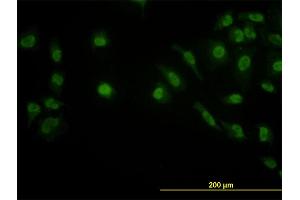 Immunofluorescence of monoclonal antibody to LDB2 on HeLa cell. (LIM Domain Binding 2 Protein 抗体  (AA 1-373))