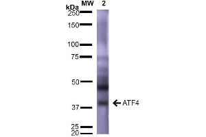 Western Blot analysis of Rat Brain showing detection of ~39 kDa (isoform 2) ATF4 protein using Mouse Anti-ATF4 Monoclonal Antibody, Clone S360A-24 . (ATF4 抗体  (AA 25-327) (Atto 488))