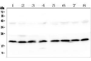 Western blot analysis of SKA2 using anti-SKA2 antibody (ABIN7603134).