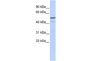 WB Suggested Anti-KCNK12 Antibody Titration:  0. (KCNK12 抗体  (Middle Region))