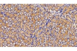 Immunohistochemistry (IHC) image for anti-Alanine Aminotransferase (ALT) (AA 143-417) antibody (ABIN7429412)