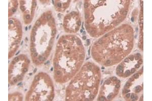 DAB staining on IHC-P; Samples: Human Kidney Tissue (ABCC10 抗体  (AA 1246-1492))