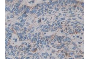 Immunohistochemistry (IHC) image for anti-Cytochrome P450, Family 21, Subfamily A, Polypeptide 2 (CYP21A2) (AA 106-389) antibody (ABIN7441886)