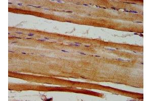 IHC image of ABIN7152365 diluted at 1:600 and staining in paraffin-embedded human skeletal muscle tissue performed on a Leica BondTM system. (EYA4 抗体  (AA 153-224))