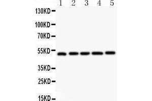 Anti-  NR1H3 antibody, Western blottingAll lanes: Anti NR1H3  at 0. (NR1H3 抗体  (C-Term))