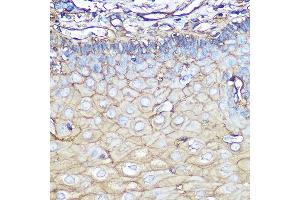 Immunohistochemistry of paraffin-embedded human esophageal using Annexin  Rabbit mAb (ABIN7265619) at dilution of 1:100 (40x lens). (Annexin A2 抗体)