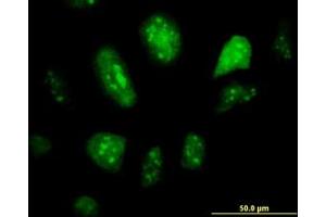 Image no. 2 for anti-Glial Cells Missing Homolog 1 (GCM1) (AA 108-166) antibody (ABIN599044) (GCM1 抗体  (AA 108-166))