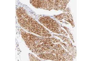 Immunohistochemical staining of human smooth muscle with ACTRT1 polyclonal antibody  shows strong cytoplasmic positivity in smooth muscle cells.
