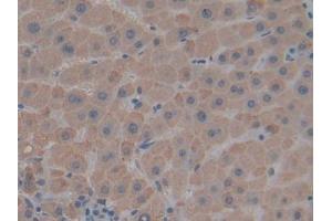 Detection of THBS1 in Human Liver Tissue using Polyclonal Antibody to Thrombospondin 1 (THBS1) (Thrombospondin 1 抗体  (AA 24-221))