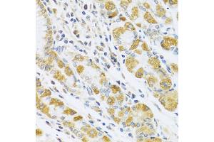 Immunohistochemistry of paraffin-embedded human stomach using PSG1 antibody (ABIN5973801) at dilution of 1/100 (40x lens). (PSG1 抗体)