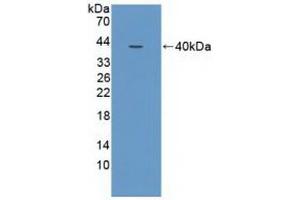 Detection of Recombinant NCOA3, Human using Polyclonal Antibody to Nuclear Receptor Coactivator 3 (NCOA3) (NCOA3 抗体  (AA 1023-1304))