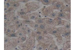 Detection of BMF in Human Liver Tissue using Polyclonal Antibody to Bcl2 Modifying Factor (BMF) (BMF 抗体  (AA 1-181))