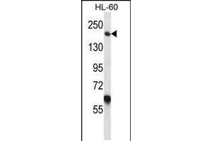 Western blot analysis in HL-60 cell line lysates (35ug/lane). (Myomesin 1 抗体  (AA 904-933))