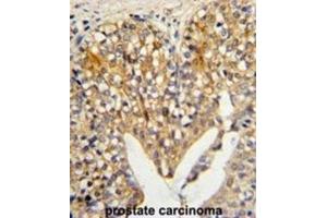 Immunohistochemistry (IHC) image for anti-Lumican (LUM) antibody (ABIN3003324) (LUM 抗体)