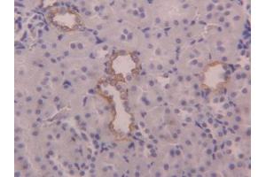 DAB staining on IHC-P; Samples: Rat Kidney Tissue (KRT6A 抗体  (AA 323-461))