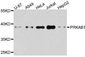 Western blot analysis of extracts of various cells, using PRKAB1 antibody.