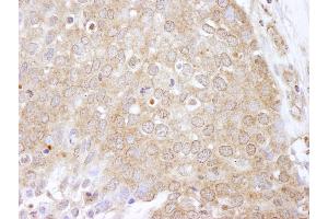 Immunohistochemistry (IHC) image for anti-Eukaryotic Elongation Factor-2 Kinase (EEF2K) (AA 675-725) antibody (ABIN7448957)