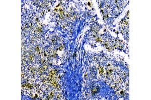 IHC analysis of ZEB2 using anti-ZEB2 antibody (ABIN3042325).