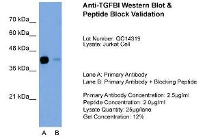 Host: Rabbit Target Name: TGFBI Sample Type: Jurkat Lane A: Primary Antibody Lane B: Primary Antibody + Blocking Peptide Primary Antibody Concentration: 2. (TGFBI 抗体  (C-Term))