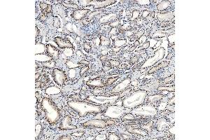 IHC analysis of U1-C/SNRPC using anti-U1-C/SNRPC antibody (ABIN7599016).