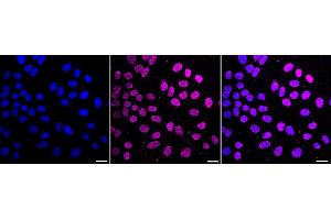 Immunocytochemical staining of HepG2 cells with Histone H4 (acetyl K16) antibody (ABIN7798978), 1:1,000). (Recombinant Histone H4 抗体  (H4K16ac))