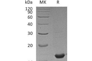 Western Blotting (WB) image for Peptidylprolyl Isomerase A (Cyclophilin A) (PPIA) protein (ABIN7320728) (PPIA 蛋白)