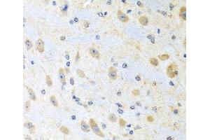 Immunohistochemistry of paraffin-embedded Mouse brain using MLN Polyclonal Antibody at dilution of 1:100 (40x lens). (Motilin 抗体)