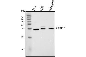 Western blot analysis of HMGB2 using anti-HMGB2 antibody (ABIN4886620). (HMGB2 抗体  (N-Term))