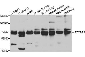 Western blot analysis of extracts of various cell lines, using STXBP3 antibody (ABIN5974503) at 1/1000 dilution. (STXBP3 抗体)
