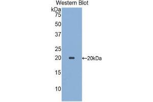 Western Blotting (WB) image for anti-Sialic Acid Binding Ig-Like Lectin 9 (SIGLEC9) (AA 23-142) antibody (ABIN2117990) (SIGLEC9 抗体  (AA 23-142))