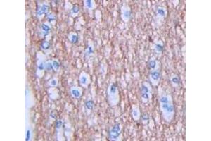 IHC-P analysis of Human Tissue, with DAB staining. (JAG1 抗体  (AA 470-834))