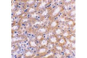 Immunohistochemical staining of mouse kidney using AP30447PU-N IRF3 antibody at 2 μg/ml. (IRF3 抗体  (C-Term))